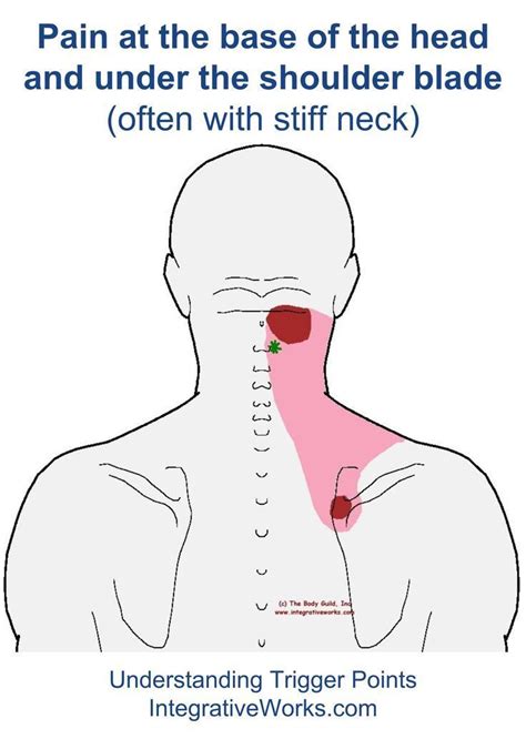 Shoulder diagram illustrations & vectors. Pin on Fibromyalgia