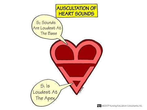 Auscultation of heart may reveal murmurs which are related to heart valve abnormalities. Nursing Mnemonics & Tricks (Assessment and Nursing Skills ...