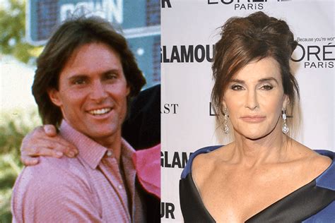 Bruce Jenner Before And After Plastic Surgery Pics