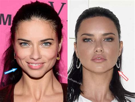 Did Adriana Lima Have Plastic Surgery Before And After 2020