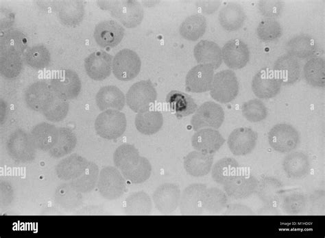 Immature Plasmodium Falciparum Hi Res Stock Photography And Images Alamy