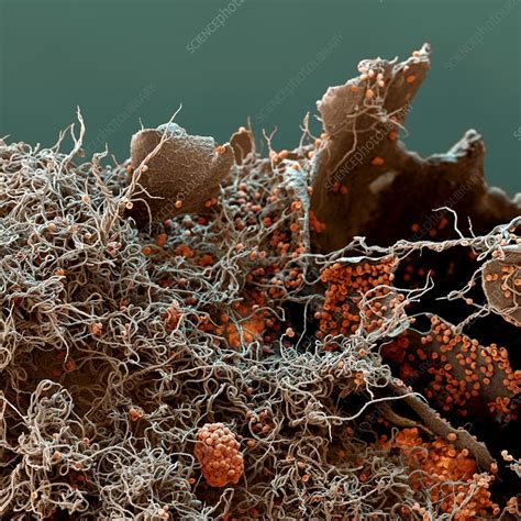 Slime mould spores, SEM - Stock Image - B250/1039 - Science Photo Library