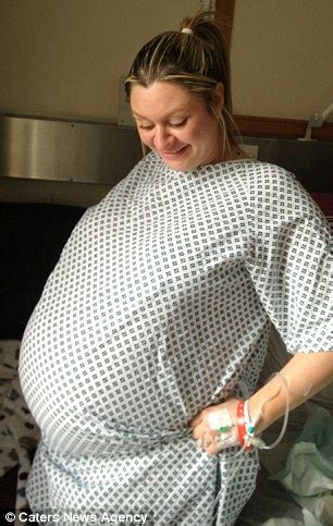 Woman With 55in Baby Bump Loses 6st 7lb She Piled On While Pregnant