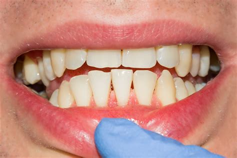 Periodontics Emergency Dentist