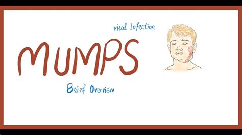 Mumps Causes Signs And Symptoms Differential Diagnoses Labs