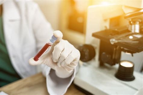 Un test sanguin pourrait détecter types de cancer avant même les premiers symptômes
