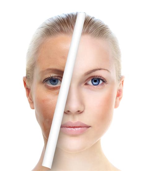 Laser Treatment Options To Rejuvenate And Restore Your Skin Radiance