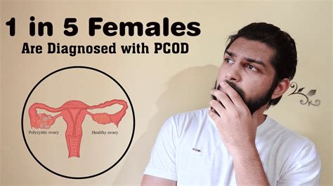 Cure Pcos And Pcod Easily At Home Youtube