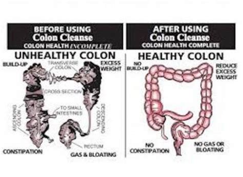 Colon Cleansing Positivemed