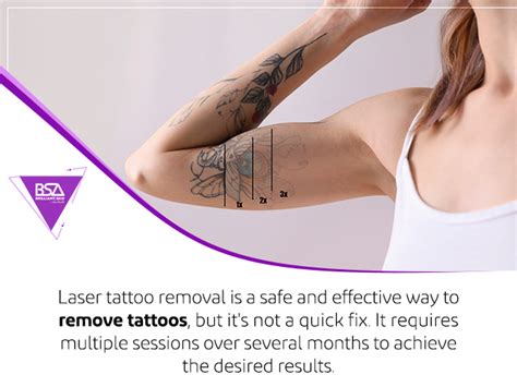 Laser Tattoo Removal After 3 Sessions