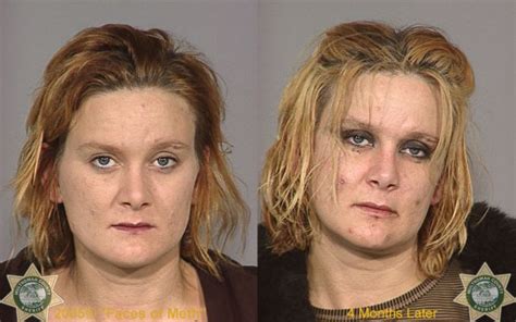 Meth Addicts Before And After 38 Pics