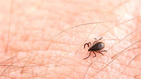 Lyme Disease Causes Symptoms And Risk Factors Health Advice Web