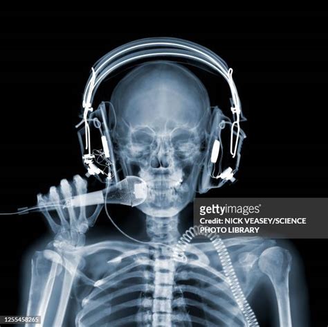 Funny Xray Photos And Premium High Res Pictures Getty Images