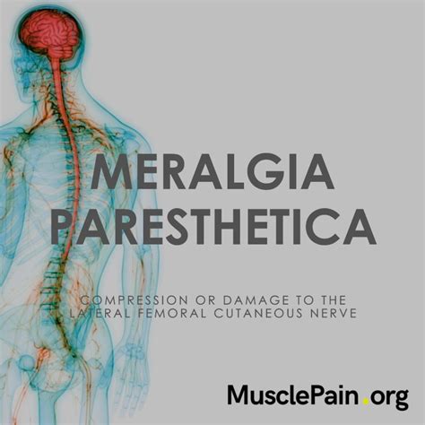 Burning Thigh Pain Paresthetic Meralgia Muscle Pain