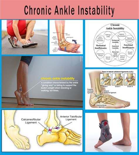 Chronic Ankle Instability Resistance Workout Sprained Ankle