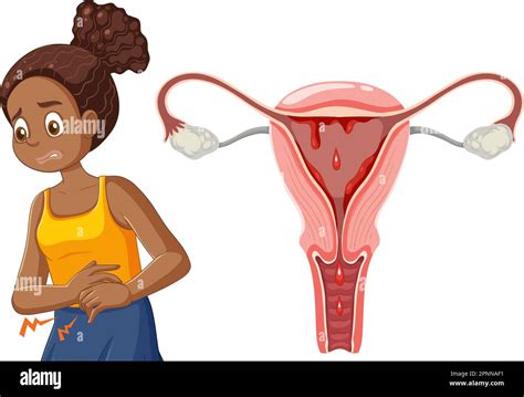 African American Girl Experiencing Menstrual Cramps During Puberty Illustration Stock Vector