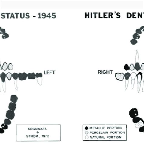 Hitlers Dental Status After Oral Information Collected From His Dental