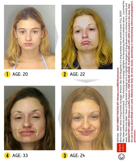 Before and after pics of crystal meth users are enough to put you off