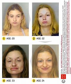 Pictures Of Before And After Meth Users
