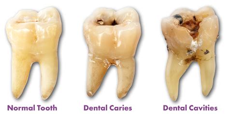 3 Commonly Confused Dental Terms — Alexandria Smiles