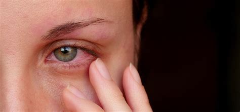 Common Eye Infections Among Adults Silverstein Eye Centers