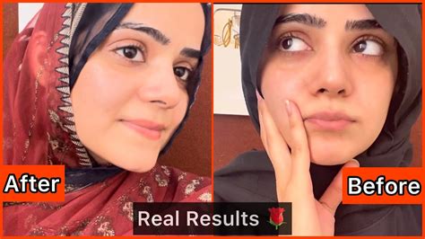 7 Day Skin Glow Challenge Bari Eid Bara Glow 😍 Eid Skin Care 2022