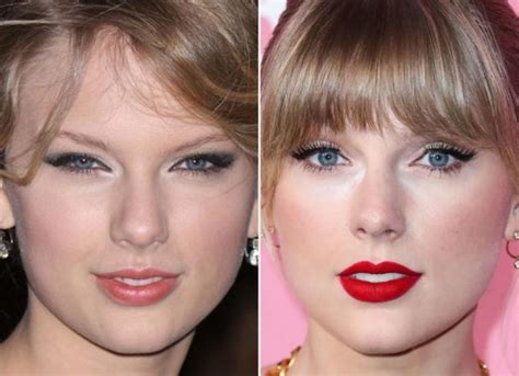Taylor Swifts Plastic Surgery Has Taylor Swift Undergone Cosmetic