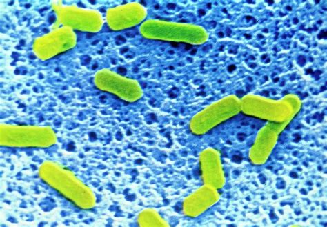 Coloured Sem Of Listeria Sp Bacteria Photograph By Cnri Science Photo