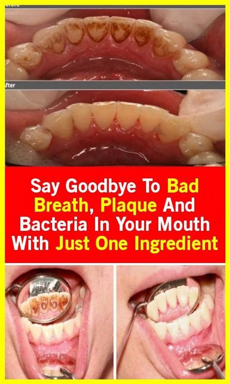 say goodbye to bad breath plaque and bacteria in your mouth with just