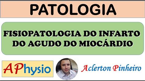 Entendendo a Fisiopatologia do Infarto Agudo do Miocárdio Causas e