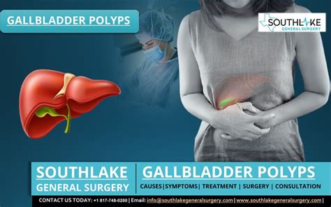 Gallbladder Polyps Causes Symptoms And Treatment Southlake General