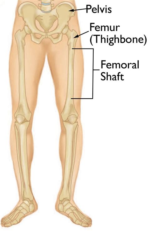 Femur Shaft Fractures Broken Thighbone Orthoinfo Aaos