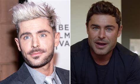 Zac Efron Explains Shattered Jaw Left His Face Swollen Last Year Capital