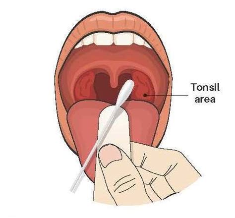 Throat Swab Gay Sex Positions Guide 12600 | Hot Sex Picture