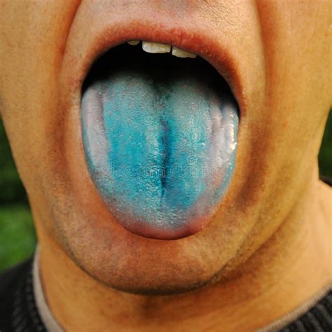 Blue Tongue Stock Image Image Of Colored Language Smile 39298303