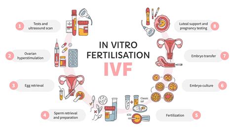 In Vitro Fertilization Ivf Vector Circle Infographic Infertility