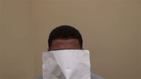 Black people usually have hair that is more curly than caucasian or other races. Black African Curly Hair Transplant Doctor Specialist FUE ...