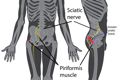 Sciatica And Low Back Pain Are They The Same Thing Specialized Physical Therapy