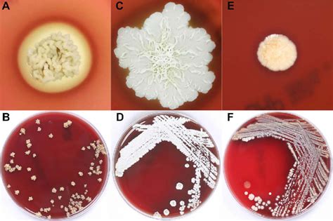 Colony Morphology Of Three Nocardia Species After 9 Days Of Columbia