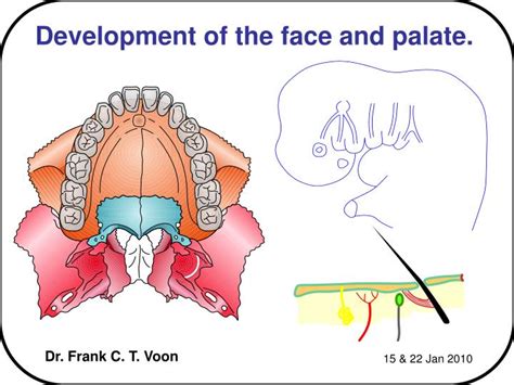 Ppt Development Of The Face And Palate Powerpoint Presentation Free