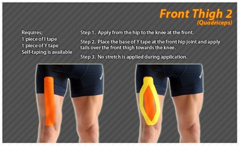 Kinesiology Taping Instructions For The Front Thigh Ktape Thigh Ares
