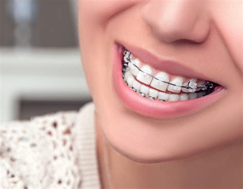 amil dental ortodontia planos odontológicos 0800 642 26 45