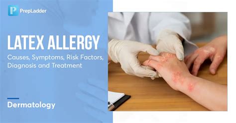Latex Allergy Causes Symptoms And Diagnosis Treatment