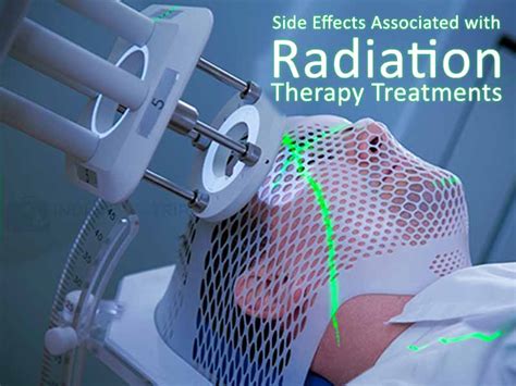 Side Effects Associated With Radiation Therapy Treatments