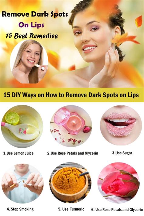 15 Effective Tips To Remove Dark Spots On Lips Dlt Beauty Remove