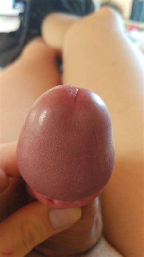 Penis Head Shapes