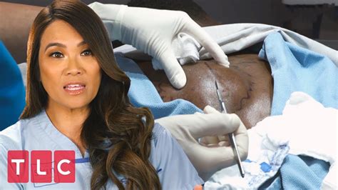 She provides services such as botox, fillers, liposuction, eye lifts and skin cancer surgery. A Dangerous Lump Near the Spine | Dr. Pimple Popper - YouTube