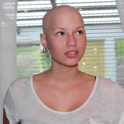 Bald And Beautiful Be Proud Bald Girl Bald Women Balding