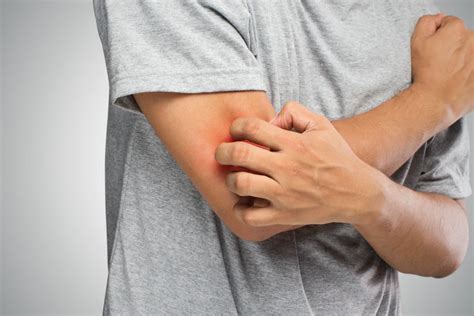 Anxiety Rash Symptoms Treatment And Prevention
