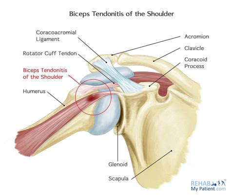 Shoulder Ligament Anatomy Diagram Supraspinatus Tendon High Resolution Stock Photography And